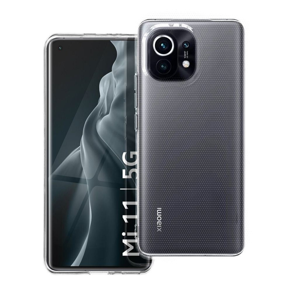 XIAOMI Mi 11 (kameravédelem) Átlátszó tok 2 mm